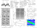 1198 ms – We see this persistent source of interference all over the place